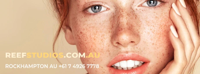 young woman with freckles