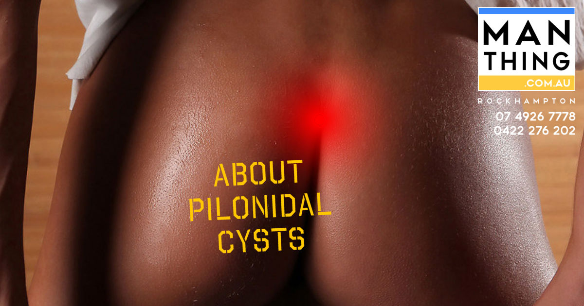 Pilonidal Cysts | Cause & Treatments